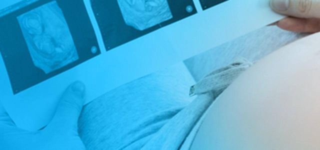 Fachgebiet Gynäkologie der HiPo Ärztevermittlung HiPo Ärztevermittlung Gynäkologie